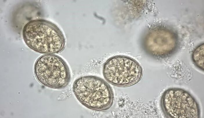 παράσιτα στο μικροσκόπιο