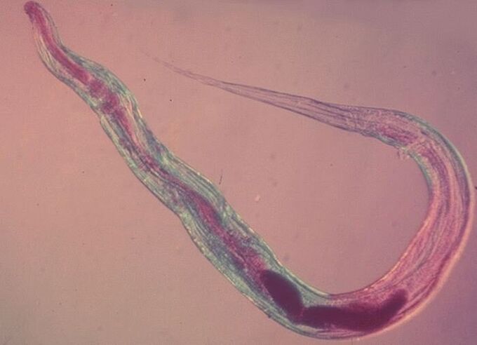Pinworm κάτω από ένα μικροσκόπιο