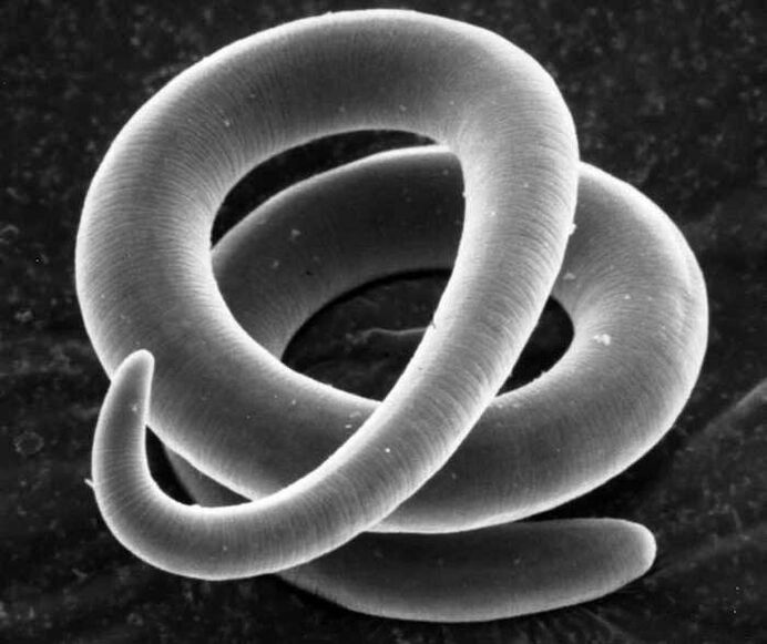 Trichinella στο μικροσκόπιο